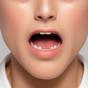 closed mouth 闭着嘴